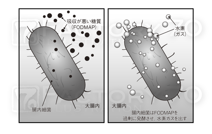医学系実用書 解説図イラスト制作例